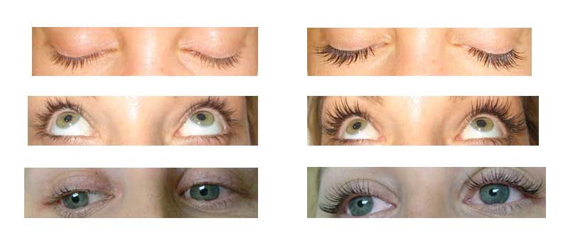 eyelash-extensions-before-and-after